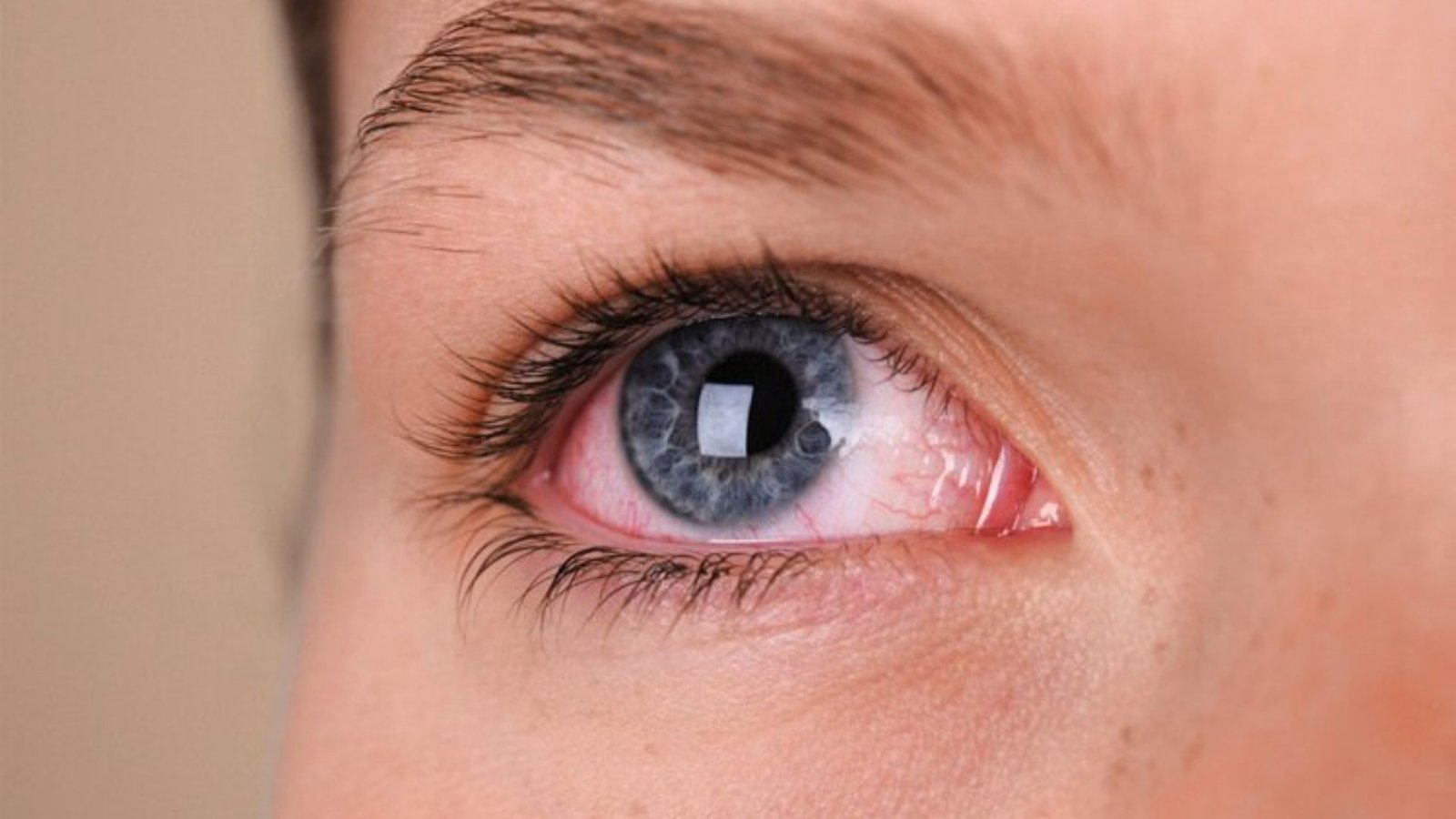 Vitrectomia Posterior (retina) | Hospital de Olhos Vasconcelos Neto