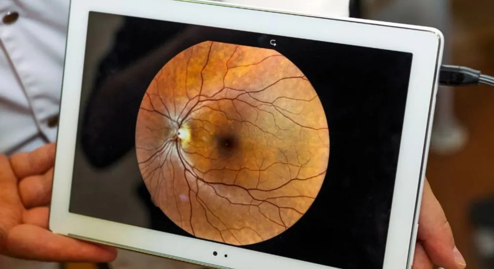 Exame de retinografia | Hospital de Olhos Vasconcelos Neto